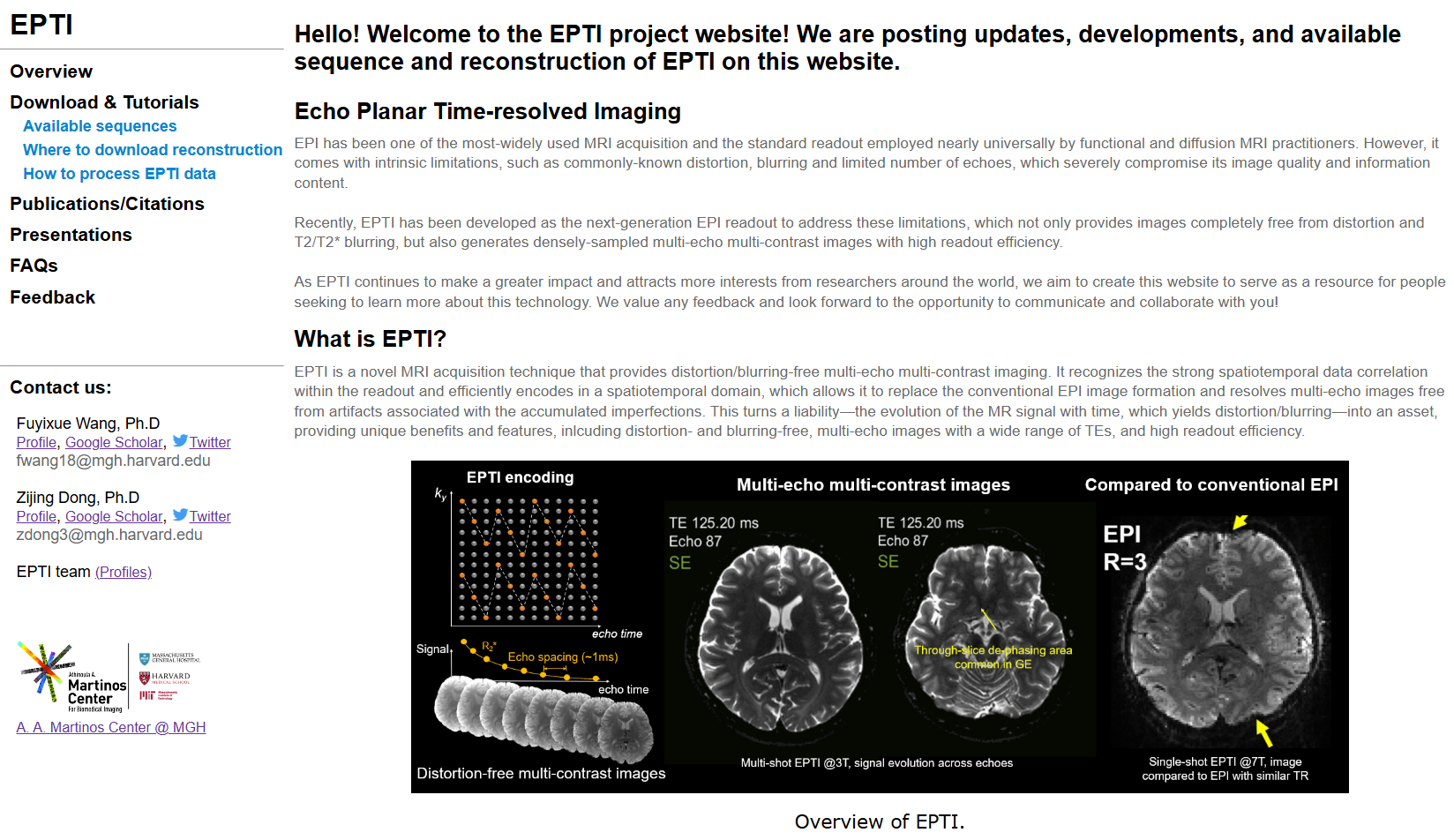 EPTI sequences are available now on C2P